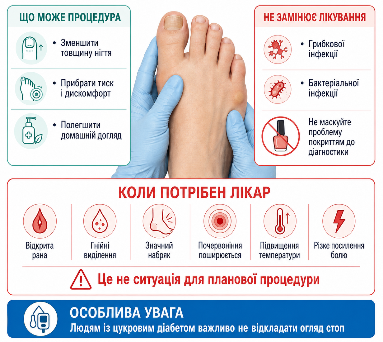 Медичний педикюр не лікує грибкові й бактеріальні інфекції: симптоми, за яких потрібен лікар.