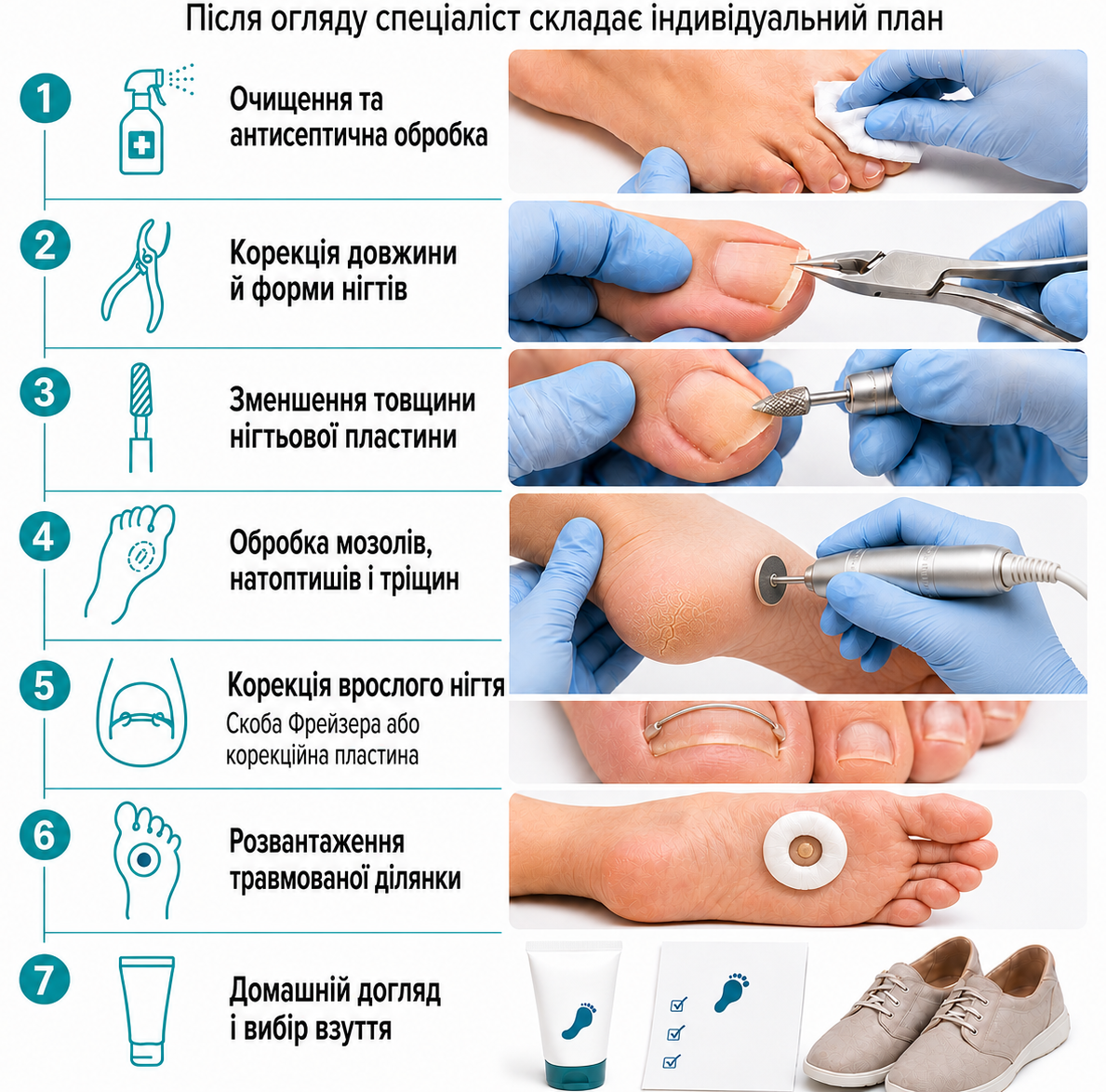 Як проходить медичний педикюр: антисептична обробка, корекція нігтів, обробка п’яти, встановлення скоби та розвантаження мозоля.